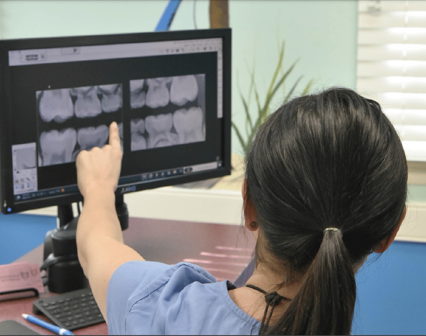 Dr-holmes-pointing-to-xray-beach-kids-dentistry Pulpotomy